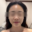 천안 피부관리 윤곽관리 잘하는 곳 “JJ에스테틱” 가격,후기