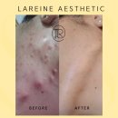 라렌에스테틱 | 김해장유피부관리 문제성 피부 전문 라렌에스테틱 김해장유점