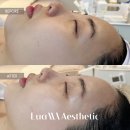 루아에스테틱광주점