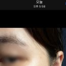 라벨라스킨케어 이미지