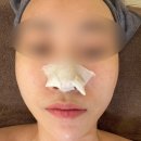 산본피부관리 치유에스테틱
