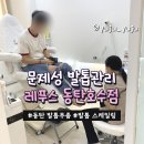 레푸스동탄 | 레푸스 동탄호수｜문제성발톱관리 후기, 발톱 스케일링