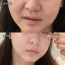 록시 | [강남 경락 추천] 얼굴 붓기 때문에 시작했다가 정착한 더록시 강남점 후기