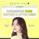 부산심미 | 부산코재수술 잘하는 곳, 전후 사례 후기 모음집
