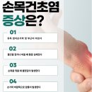 목동기운찬마취통증의학과의원 | 목동 통증의원, 손목에 짜릿한 증상 손목건초염 알아보세요