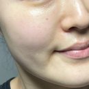 라온메디 | 라온메디 멜라스마 케어 크림 잡티기미 제거 크림 2주 사용후기