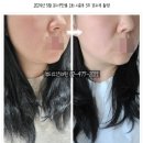 파크피부과의원 | 위례 하남 뷰티오션의원 : beauty pop! 울쎄라 텐써마 제네시스토닝 올리지오 / 8월 피부과 이벤트