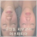 에스테티아 인천구월1호점 | 구월동피부관리 추천 에스테티아 인천구월1호점 솔직후기