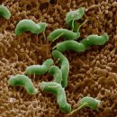 위암의 원인! 헬리코박터균을 없애는데 좋은 음식 이미지