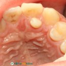 자라진천 이미지