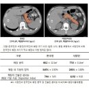 한국인은 못 먹는 도넛 이미지