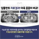 삼성플란트치과의원 이미지
