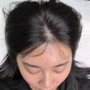 공릉두피염색 아름다움라움에서 정수리 컬러링 대만족 후기