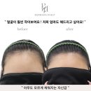 수헤어라인 이미지