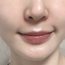 필업뷰티 | ✨ PDRN 세럼 추천, 엑솔 필업 세럼으로 피부광채와 탄력 케어 시작!
