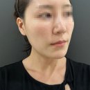 신사인테리어 | [신사피부과후기] 신사역 스컬트라 전후, 위치 주의사항 정보
