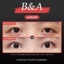 아이컨텍성형외과의원 이미지