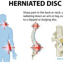 진주참신경외과의원 | 진주신경외과, 허리 통증 참다가 후회하는 분들이 많습니다
