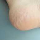 (주)케어풋솔루션 네이버블로그