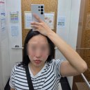 지우의원 | [영등포 사려니의원] 편평사마귀/비립종/점 제거 내돈내산 찐후기 (가격, 관리법 총정리)