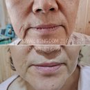 쏠베라 화장품으로 즉시 성형! 플러스아르베라 역대급후기 (쏠베라 영덕, 포항, 울산, 대구)