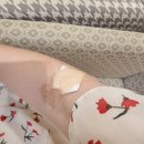 김도균외과의원 | 심부자궁내막증) #1, 자궁내막증 수술 결정, 진통제 처방, 로렐린데포주사 1회(부작용), 선오가닉키친