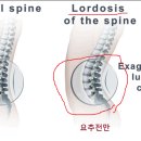 엎어치기 방지법 (1) - 오른어깨 래깅 + 요추전만 이미지