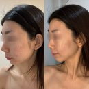 하이엔드 에스테틱 엘루엔에스테틱 강남본점에서 피부 케어 받다!