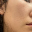 세븐일레븐 의정부센트럴타워점 | 의정부 여드름압출 트러블피부 뷔에르뷰티 내돈내산 방문