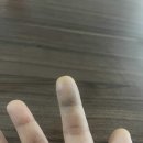 예손병원 티스토리