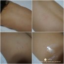 [대표카페 지후맘] 고려제약 아토아이비 로션 클렌저 세트로 우리 아기 피부를 지켜요