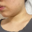 홈 | 5주차 사용후기 [홈모드써마리프트] 내돈내산