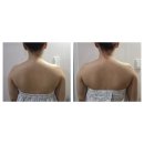 뷰티힐에스테틱 | 부산 연산동 에스테틱 뷰티힐에스테틱 마이크로웨이브 등관리 피부관리 후기