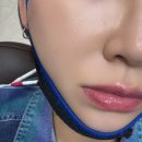 미래치과기공소 | [평택 고덕신도시 치과 추천] 5년의 턱관절 통증과 이갈이, 드디어 정착한 이래치과 찐 후기 - 내돈내산
