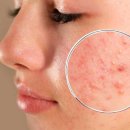 씨엘메디칼 이미지