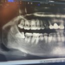 동탄탑치과의원 이미지