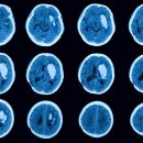 에스스포츠 이미지