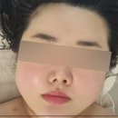 라피움 이미지