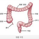 암에 대해 알고 싶다 - 대장암 이미지