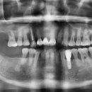 양평백상치과의원 이미지