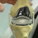 초이스병원 이미지