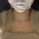 발산역피부과 쥬브겔 입술필러 추천 후기