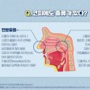 코피가 자주 나는 이유 원인 잦은 코피 멈추는법 이미지