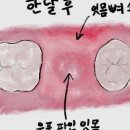 라페치과의원 네이버블로그