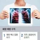 폐암보다 치명적인 폐렴, 호흡부전·패혈증 때문 이미지