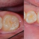 당신이웃는치과의원 이미지