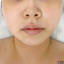 여운1 | 신림 피부관리 추천 에스테틱여운 1회만에 얼굴라인 변화 후기 (맞춤관리)