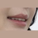 세모치과의원 | 나의 교정일기(덧니 비발치 교정) - 판교 연세미소엘치과 추천