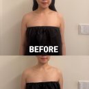 라인 | 12. 창원 웨딩관리 팔뚝 목어깨 라인 후기 라운드어바웃 내돈내산