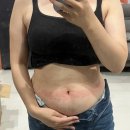 필약국 | 플로라필 부작용? 40대 내돈내산 다이어트 후기